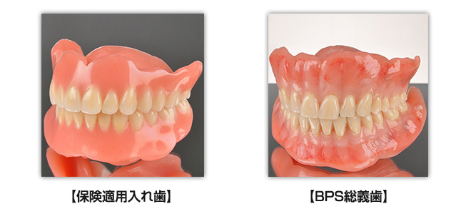 保険適用入れ歯とBPS総義歯の違い